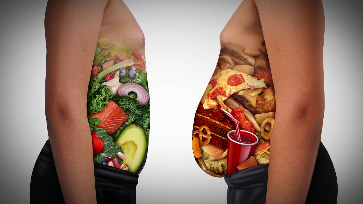 Causes of obesity are far more complex than simply what someone eats. Picture Shutterstock